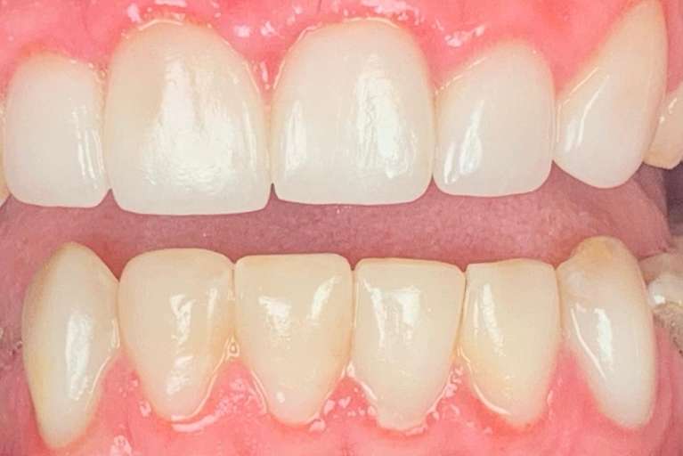 BioClear-After-Image