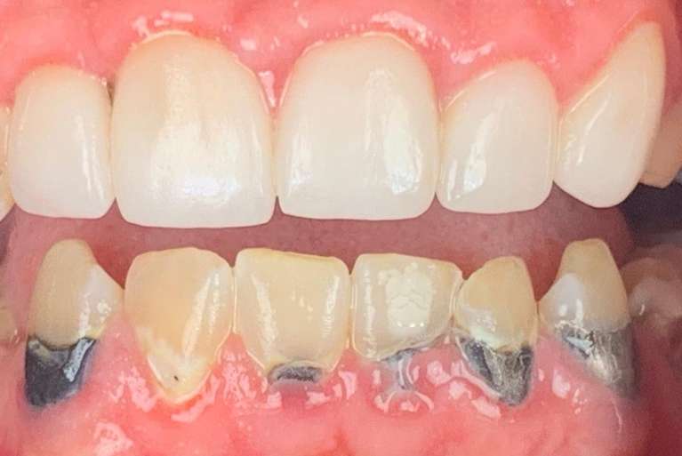 BioClear-Before-Image