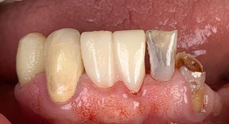 BioClear-Before-Image